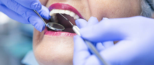Best Urgent Care for Lost Fillings or Crowns in Simpson, PA